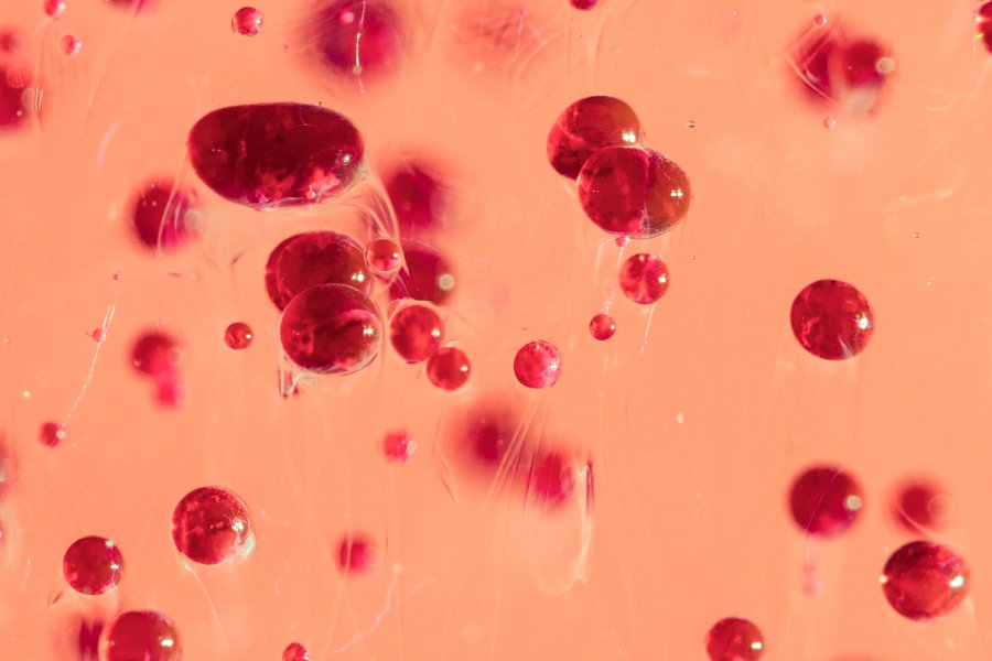 Прогноз и профилактика