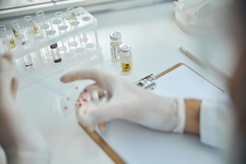 Что такое спондилоартроз — 5