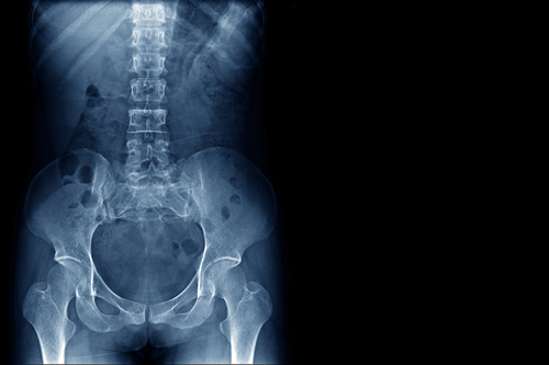 Рентген брюшной полости - фото 3