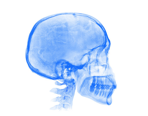 Рентген головы - фото 2