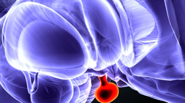 Рак мочевого пузыря