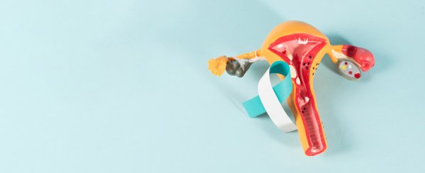 Рак шейки матки