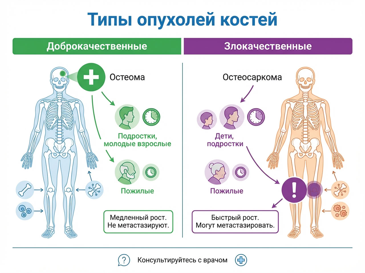 Опухоли костей и хрящей — 2