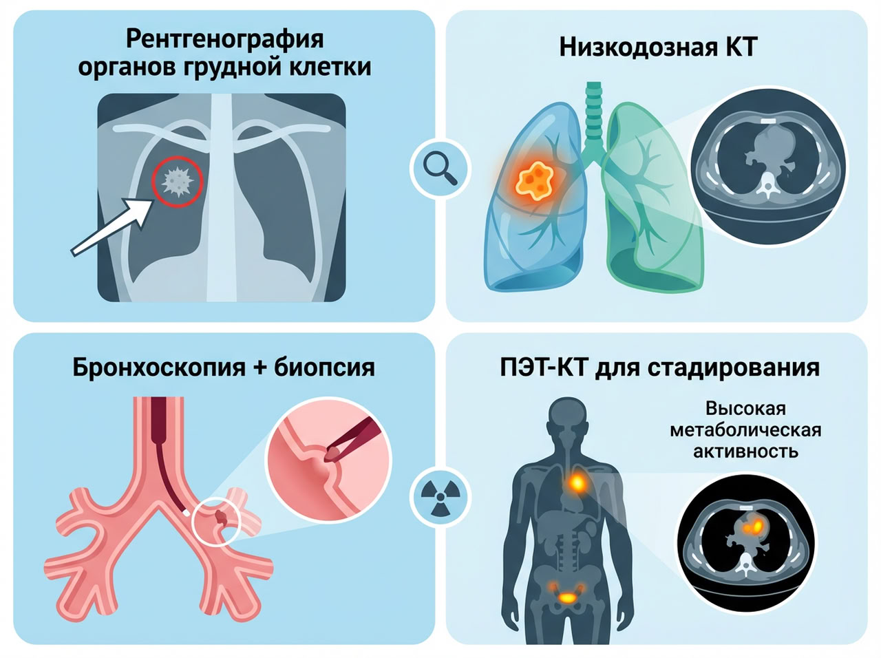 Рак легкого — 3