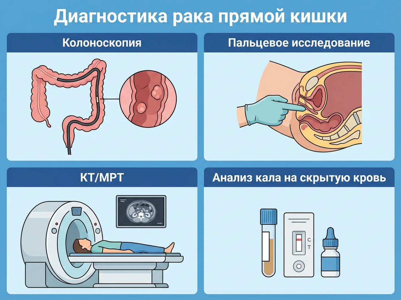 Рак прямой кишки — 4