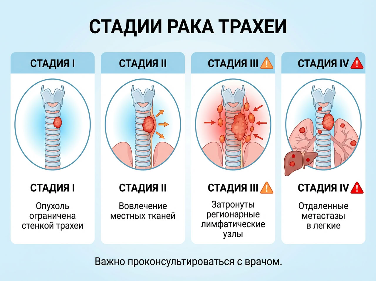 Симптомы рака трахеи — 3