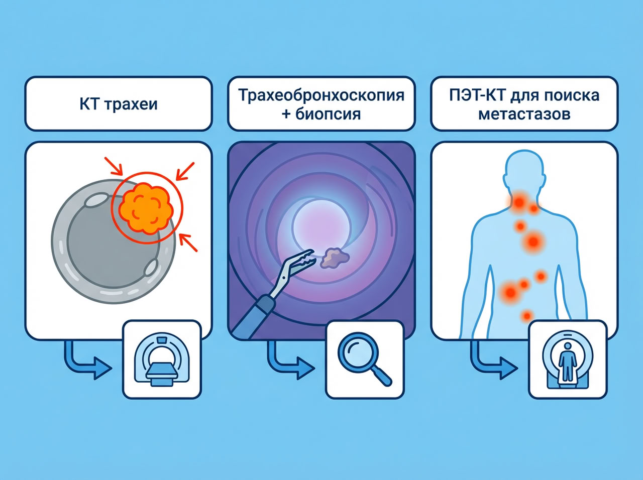 Симптомы рака трахеи — 4