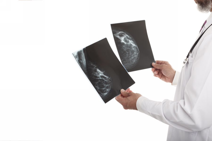 Что показывает маммография